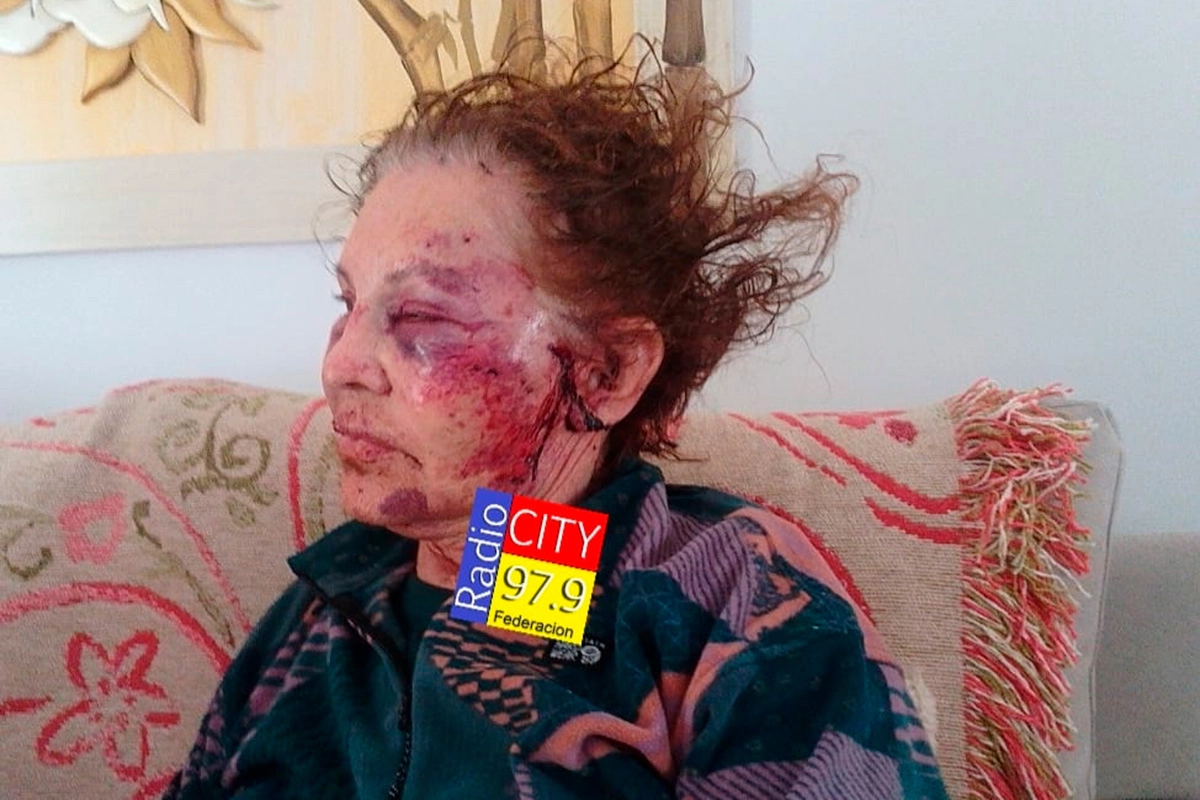 Así quedó la mujer. Foto: Radio City.