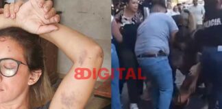 Una vendedora ambulante golpeada y pide la liberación de su esposo. Foto: Elochodigital
