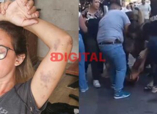Una vendedora ambulante golpeada y pide la liberación de su esposo. Foto: Elochodigital