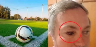 Violencia en el fútbol - Aldo Tisocco. Foto: Tal Cual