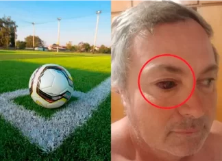 Violencia en el fútbol - Aldo Tisocco. Foto: Tal Cual