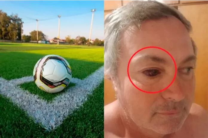 Violencia en el fútbol - Aldo Tisocco. Foto: Tal Cual